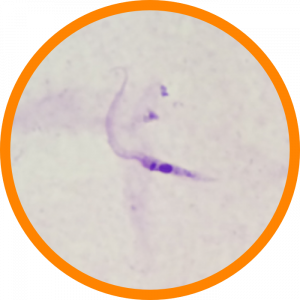 Microscopic enlargement of Chagas