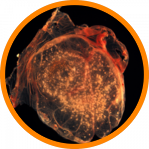Microscopic enlargement of Orthopoxvirus